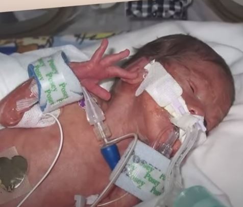 Doctors witness miracle 20 minutes after baby born without a heartbeat